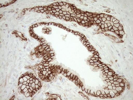 Pan-CDH Antibody in Immunohistochemistry (Paraffin) (IHC (P))