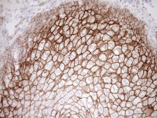 Pan-CDH Antibody in Immunohistochemistry (Paraffin) (IHC (P))