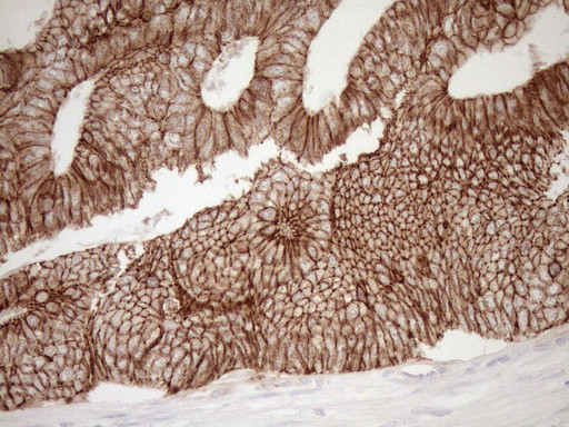 Pan-CDH Antibody in Immunohistochemistry (Paraffin) (IHC (P))