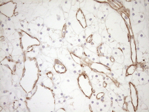 Pan-CDH Antibody in Immunohistochemistry (Paraffin) (IHC (P))