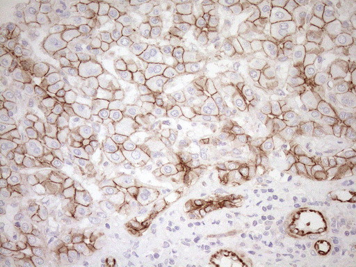 Pan-CDH Antibody in Immunohistochemistry (Paraffin) (IHC (P))