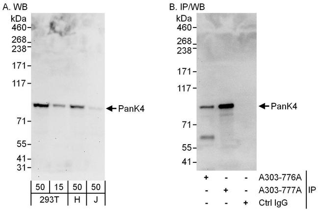 PanK4 Antibody in Western Blot (WB)