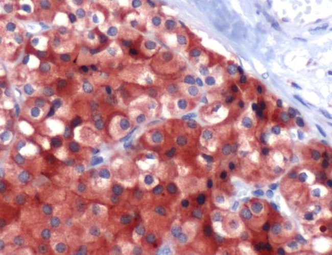 PTH Antibody in Immunohistochemistry (IHC)