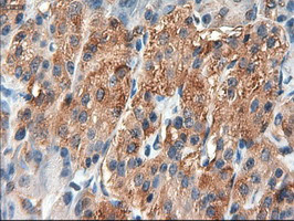 Patched1 Antibody in Immunohistochemistry (Paraffin) (IHC (P))