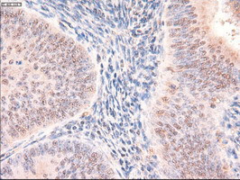 Patched1 Antibody in Immunohistochemistry (Paraffin) (IHC (P))