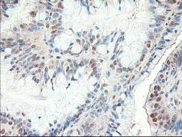 Patched1 Antibody in Immunohistochemistry (Paraffin) (IHC (P))