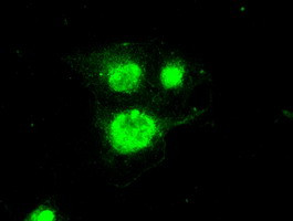 Periostin Antibody in Immunocytochemistry (ICC/IF)