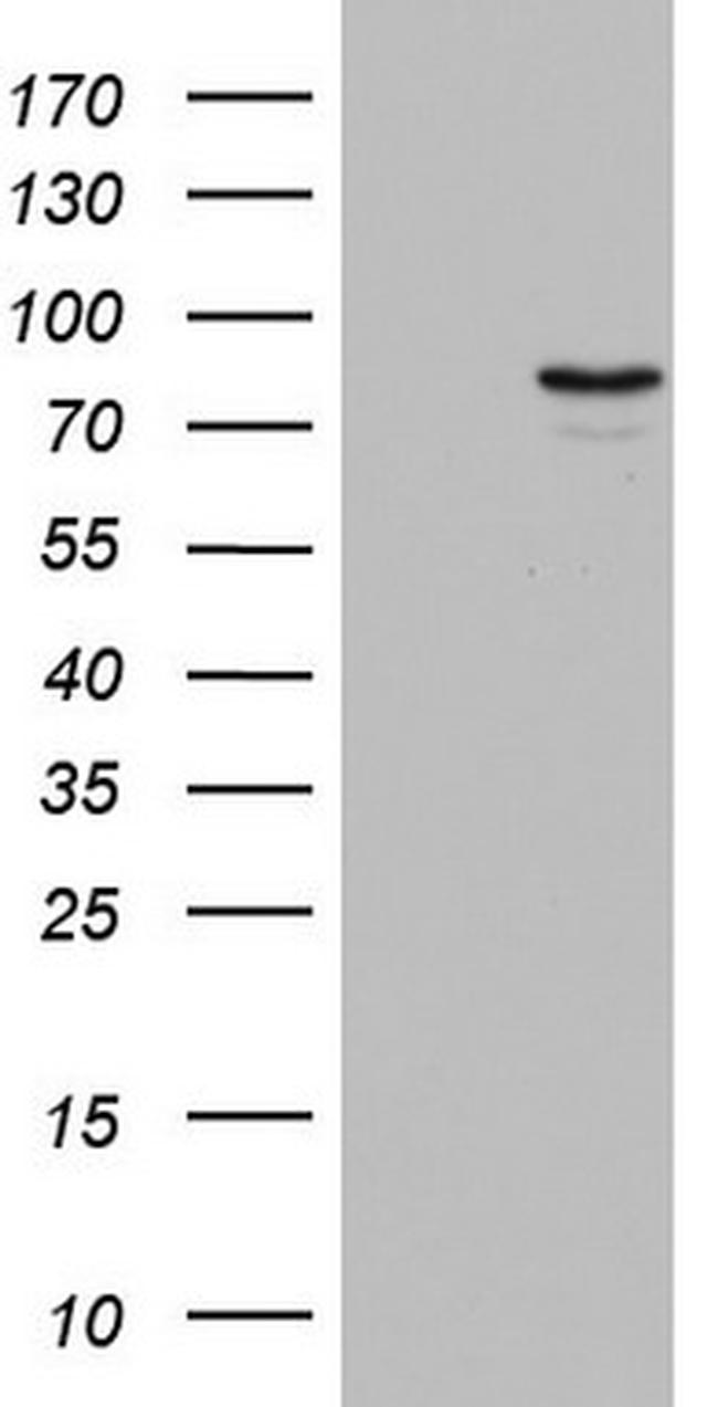 Periostin Antibody in Western Blot (WB)