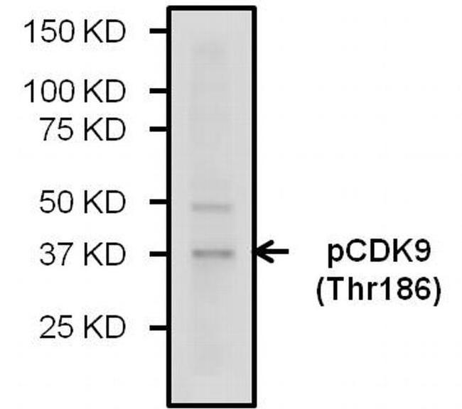 Phospho-CDK9 (Thr186) Antibody in Western Blot (WB)