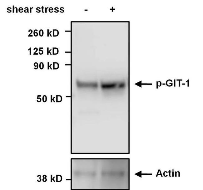 Phospho-GIT1 (Tyr554) Antibody in Western Blot (WB)