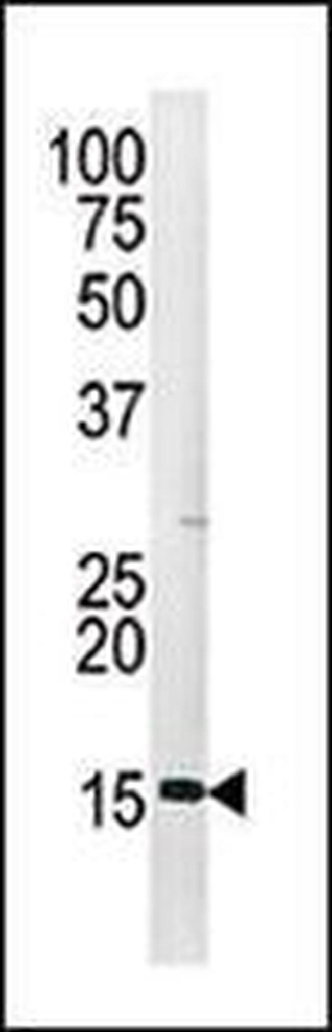 Phospho-Histone H3 (Ser28) Antibody in Western Blot (WB)