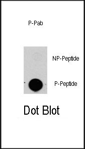 Phospho-HPK1 (Thr165) Antibody in Dot Blot (DB)