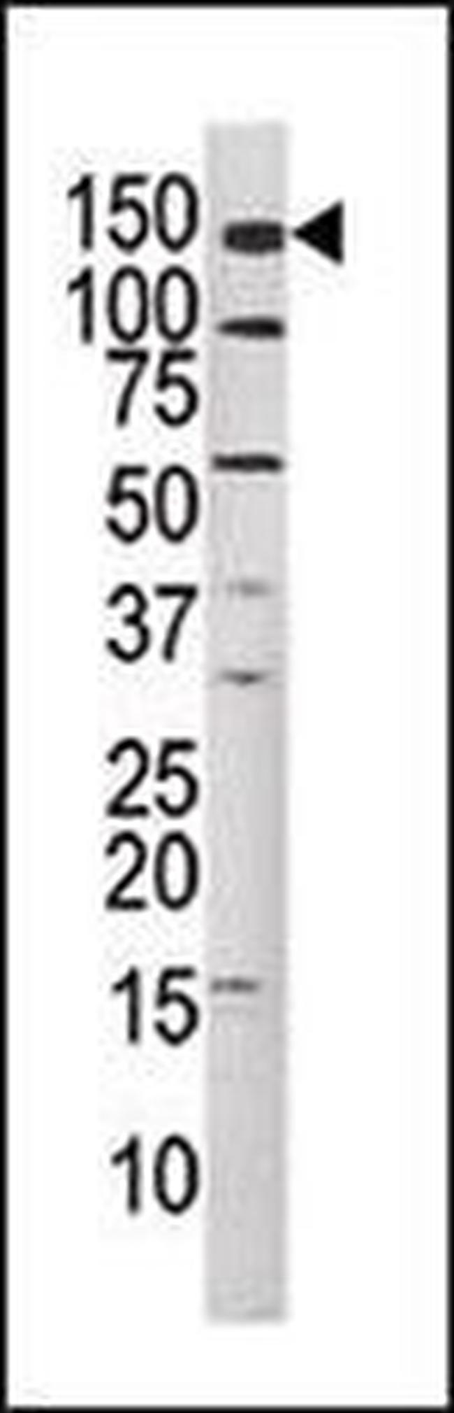 Phospho-c-Met (Tyr1349) Antibody in Western Blot (WB)