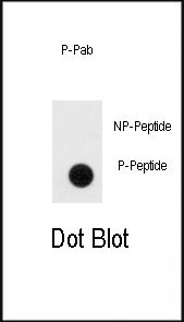 Phospho-RUNX2 (Ser465) Antibody in Dot Blot (DB)