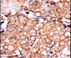 Phospho-RAD9 (Ser328) Antibody in Immunohistochemistry (Paraffin) (IHC (P))