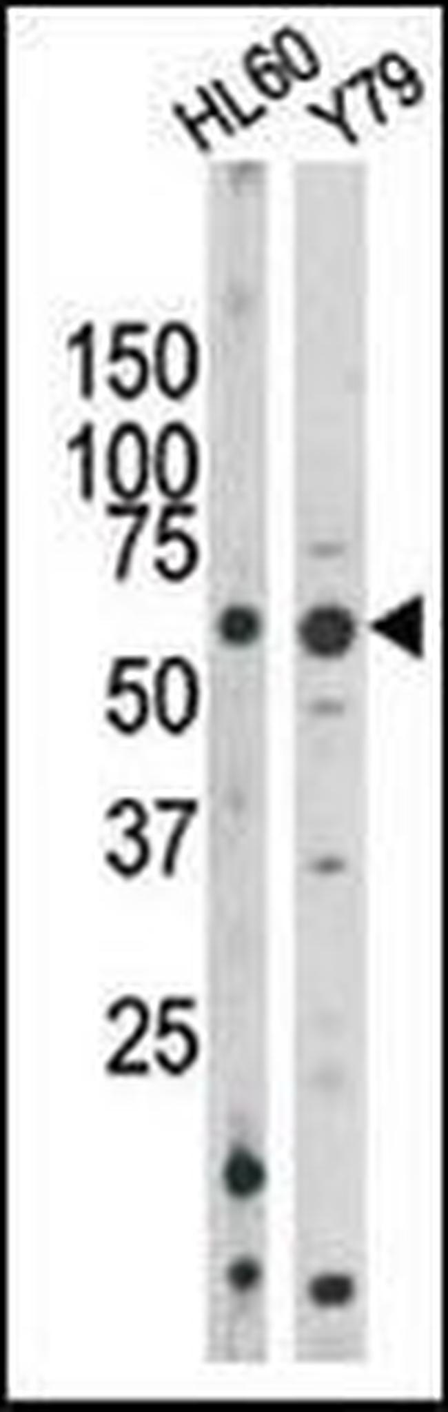 Phospho-RAD9 (Ser328) Antibody in Western Blot (WB)