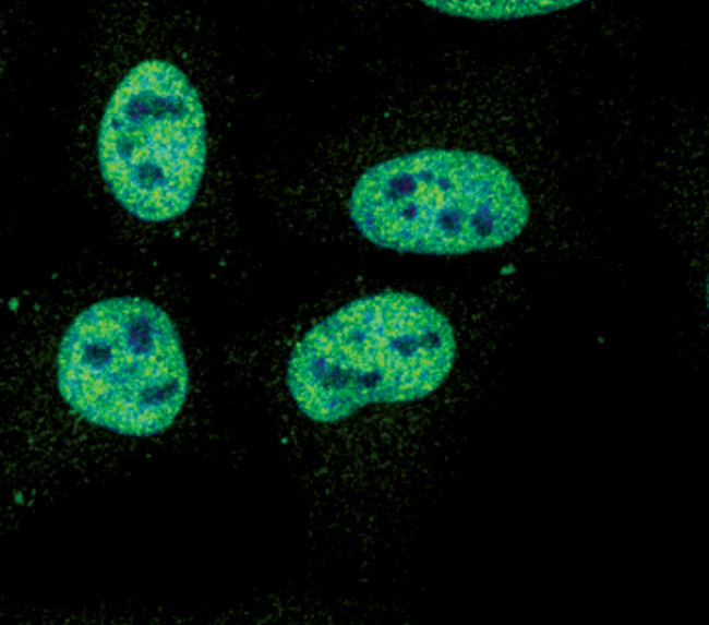 Phospho-STAT1 (Tyr701) Antibody in Immunocytochemistry (ICC/IF)