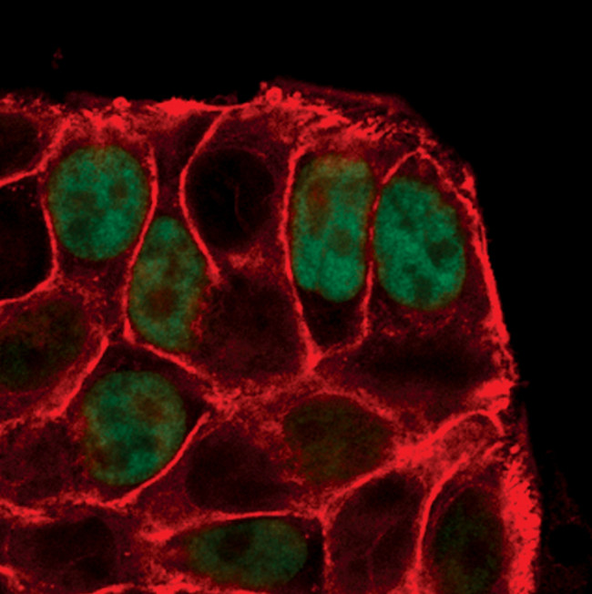 Phospho-p53 (Ser15) Antibody in Immunocytochemistry (ICC/IF)