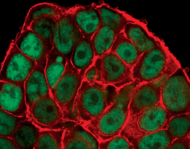 Phospho-p53 (Ser15) Antibody in Immunocytochemistry (ICC/IF)