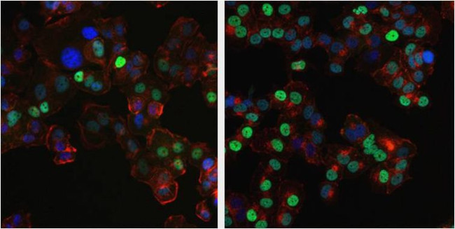 Progesterone Receptor Antibody in Immunocytochemistry (ICC/IF)