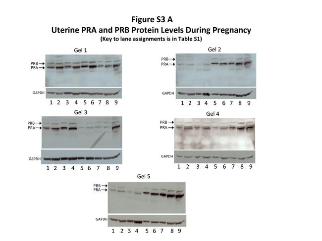 Progesterone Receptor Antibody in Western Blot (WB)