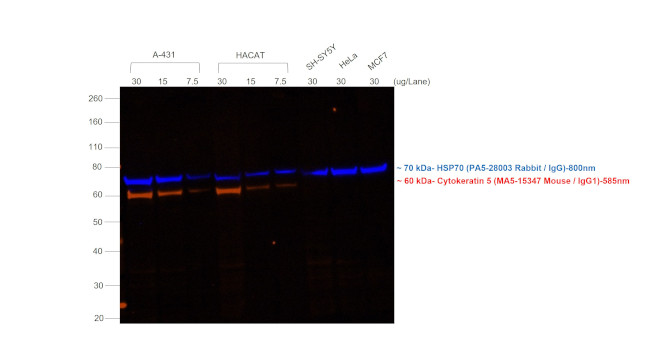 Mouse IgG (H+L) Secondary Antibody in Western Blot (WB)