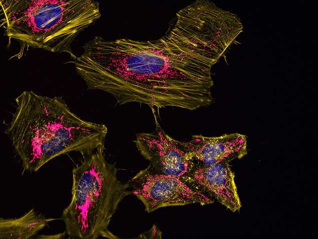 Mouse IgG (H+L) Secondary Antibody in Immunocytochemistry (ICC/IF)