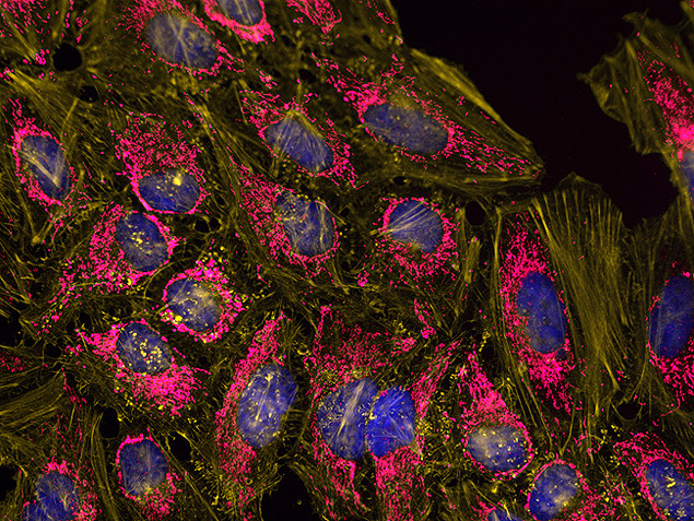 Mouse IgG (H+L) Secondary Antibody in Immunocytochemistry (ICC/IF)