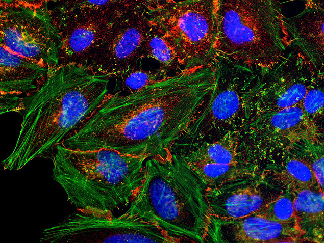 Rabbit IgG (H+L) Secondary Antibody in Immunocytochemistry (ICC/IF)