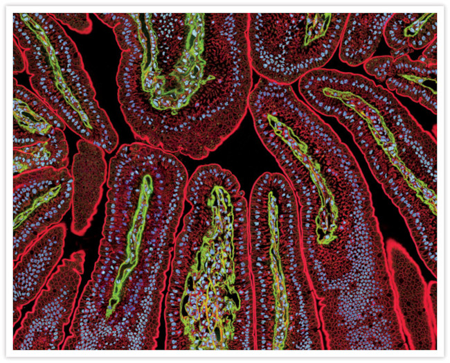 Rabbit IgG (H+L) Secondary Antibody in Immunohistochemistry (IHC)