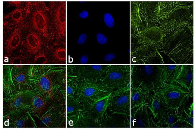 Rat IgG (H+L) Secondary Antibody in Immunocytochemistry (ICC/IF)