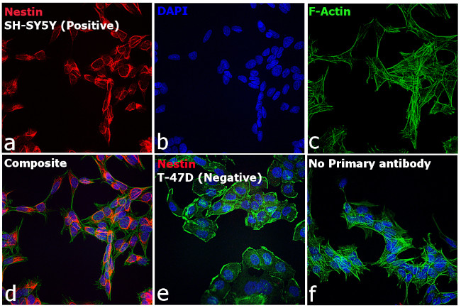 Mouse IgG (H+L) Secondary Antibody in Immunocytochemistry (ICC/IF)