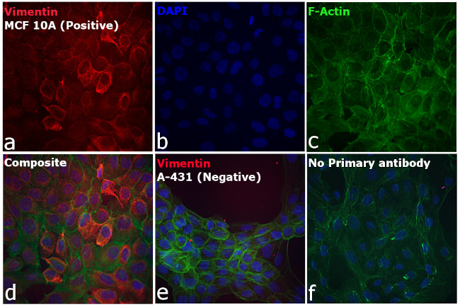 Rabbit IgG (H+L) Secondary Antibody in Immunocytochemistry (ICC/IF)