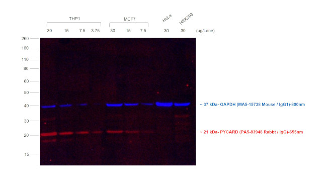 Rabbit IgG (H+L) Secondary Antibody in Western Blot (WB)