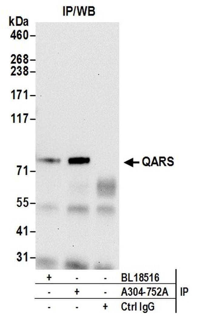 QARS Antibody in Western Blot (WB)