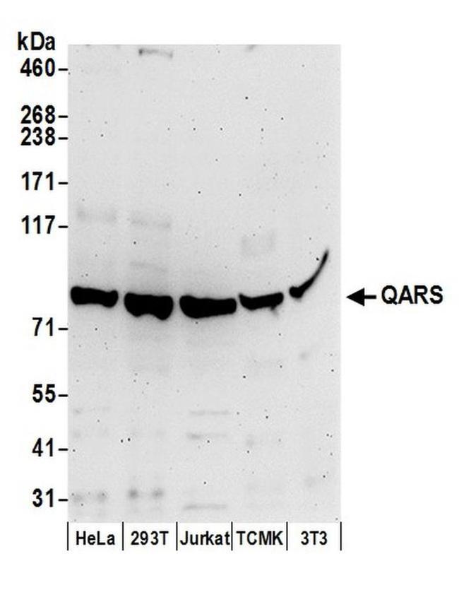 QARS Antibody in Western Blot (WB)