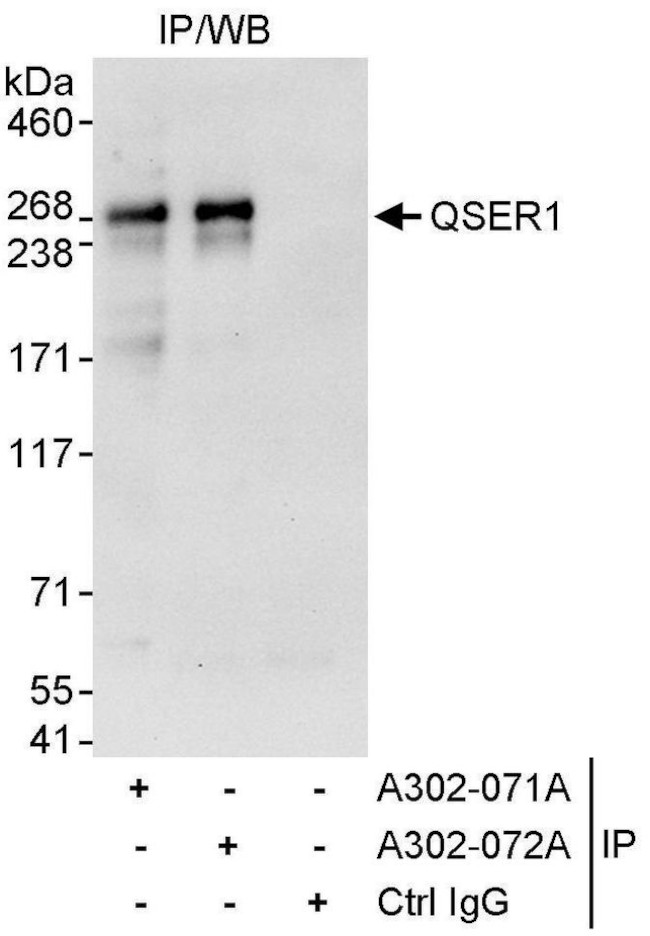 QSER1 Antibody in Immunoprecipitation (IP)