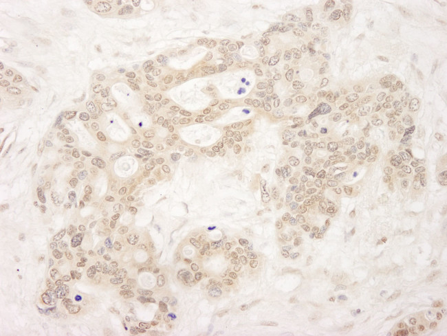 QSER1 Antibody in Immunohistochemistry (IHC)