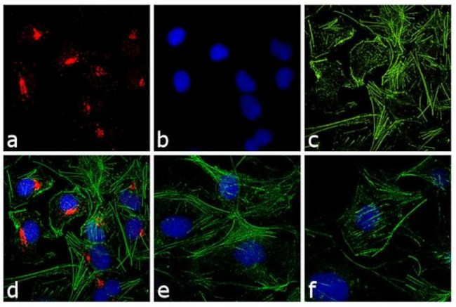 Rabbit IgG (H+L) Cross-Adsorbed Secondary Antibody in Immunocytochemistry (ICC/IF)