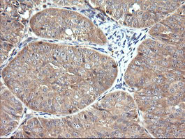 RAB21 Antibody in Immunohistochemistry (Paraffin) (IHC (P))