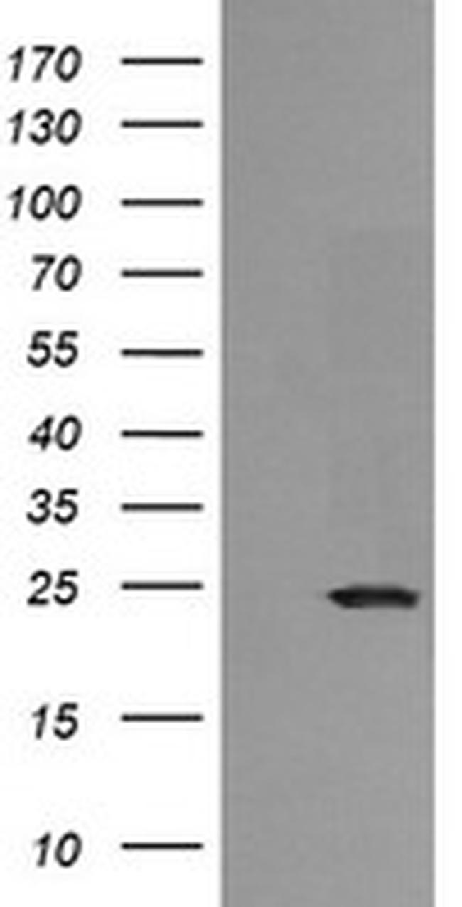 RAB21 Antibody in Western Blot (WB)