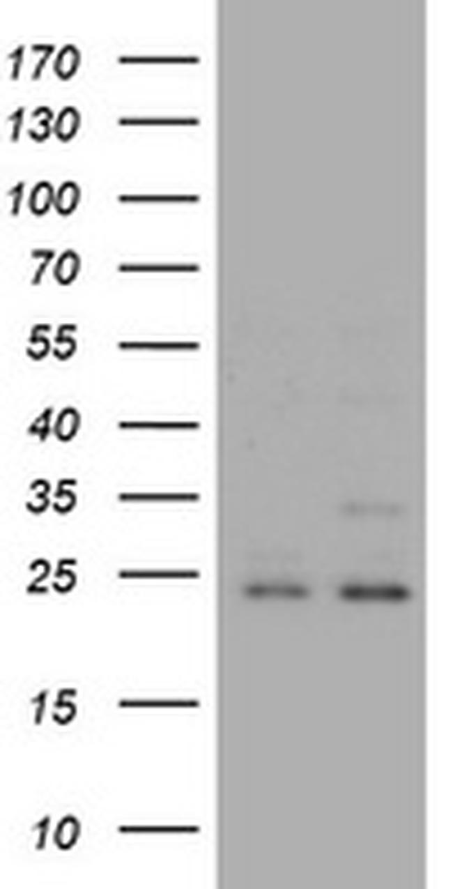 RAB21 Antibody in Western Blot (WB)