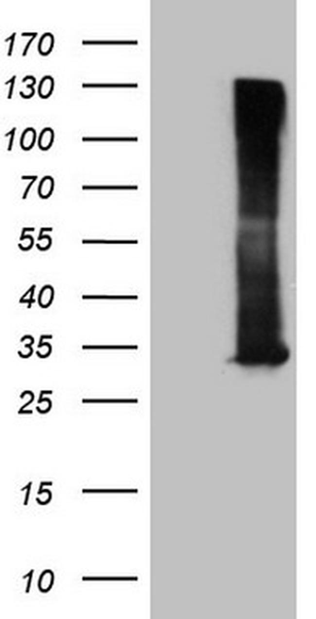 RAB3A Antibody in Western Blot (WB)