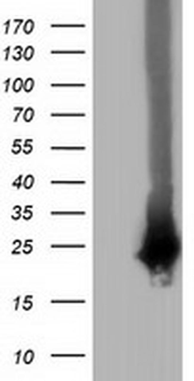 RABL2A Antibody in Western Blot (WB)