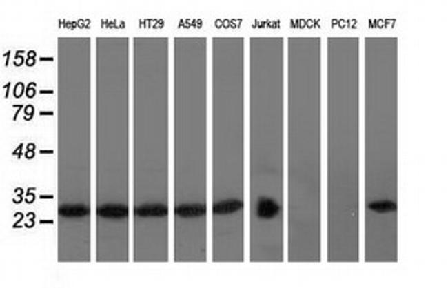 RABL2A Antibody in Western Blot (WB)