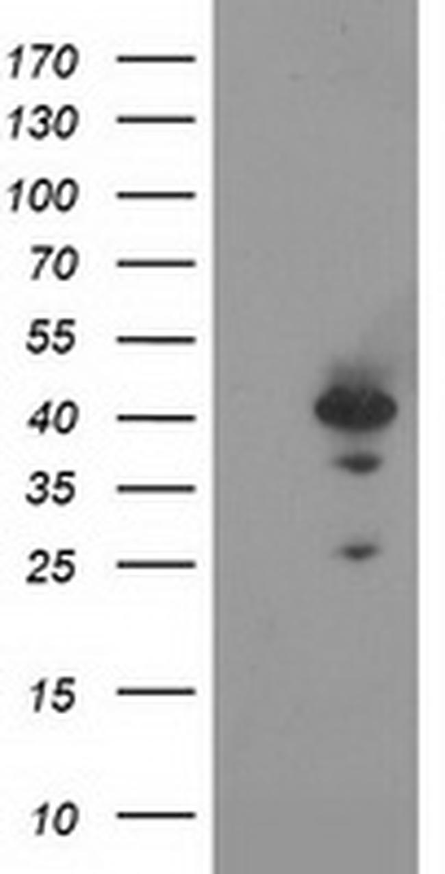RAD51L1 Antibody in Western Blot (WB)