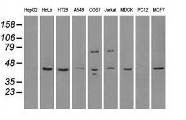 RAD9A Antibody in Western Blot (WB)