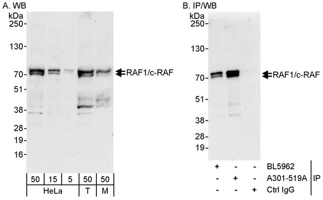 RAF1/c-RAF Antibody in Western Blot (WB)