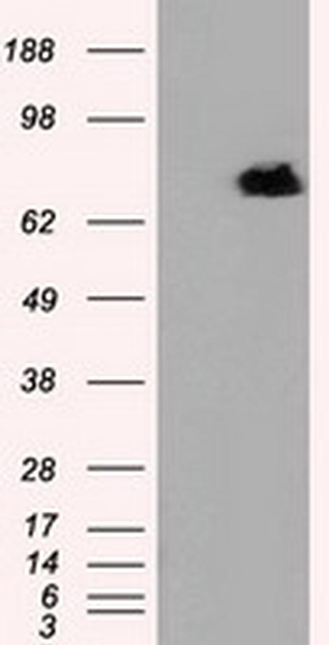 RALBP1 Antibody in Western Blot (WB)