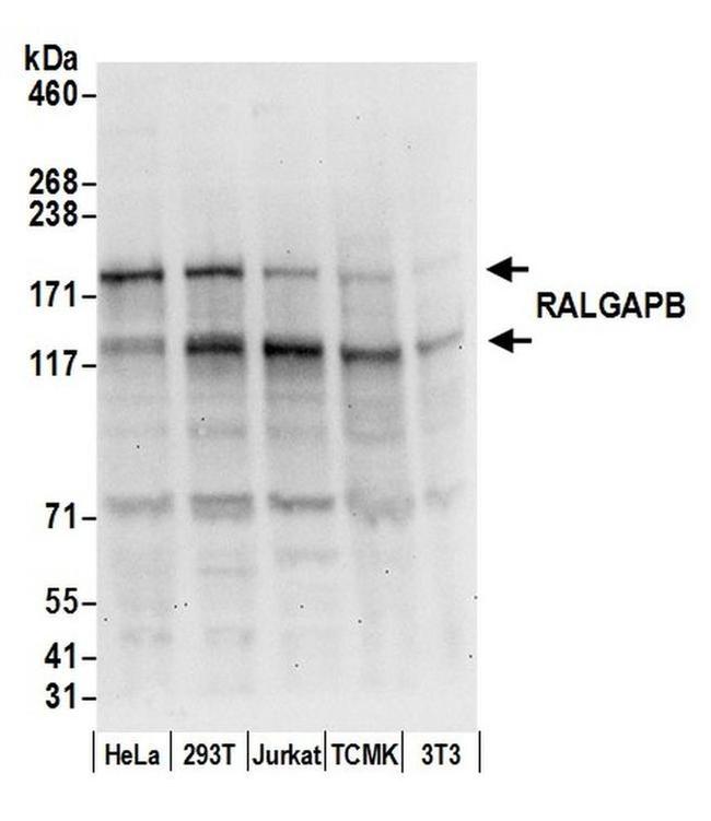 RALGAPB Antibody in Western Blot (WB)